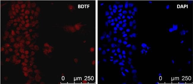 FAC1 / BPTF Antibody (clone 2F10)