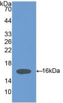 HPSE / Heparanase Antibody (aa280-412)