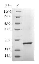 Plasmodium berghei Plasmodium falciparum Protein (Recombinant 6His, N-terminus)