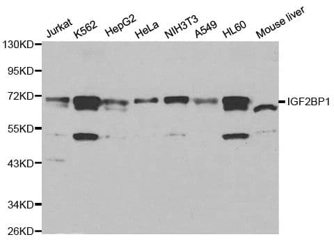 CRD-BP / ZBP1 / IGF2BP1 Antibody