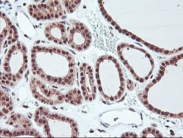HES1 / HES-1 Antibody (clone OTI1B5, Carrier-free)