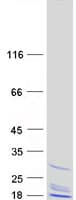 Human REEP1 Protein (Recombinant Myc-DDK (Flag))