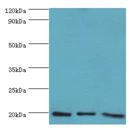 NAT5 / NAA20 Antibody (aa49-178)