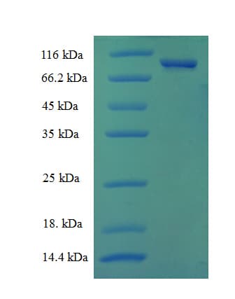 Human CNDP2 Protein (Recombinant His)