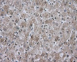APP / Beta Amyloid Precursor Antibody (clone OTI5F1)