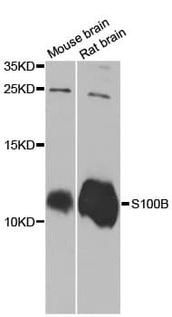 S100B / S100 Beta Antibody