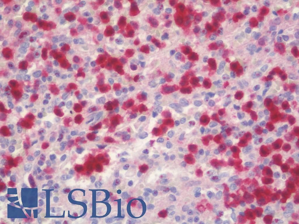 IHC-plus™ PGD Antibody (clone 2A5)