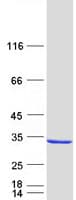 Human CMBL Protein (Recombinant Myc-DDK (Flag))