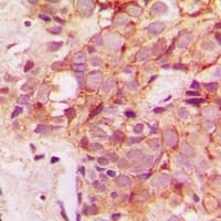 Polyclonal Rabbit anti-Human IRAK3 / IRAKM / IRAK-M Antibody (C-Terminus, IHC, IF, WB)