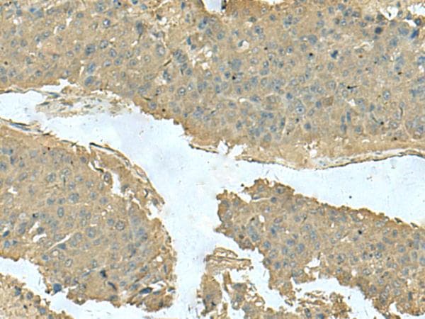 Polyclonal Rabbit anti-Human KRT36 / Keratin 36 / KRTHA6 Antibody (IHC, WB)