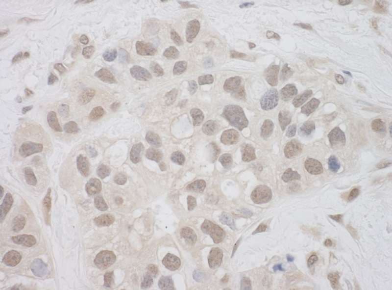 SPT7L / SUPT7L Antibody (aa364-414)