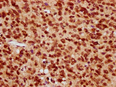Polyclonal Rabbit anti-Human HIST1H4I Antibody (IHC, WB)