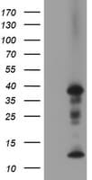 PDLIM2 / SLIM Antibody (clone OTI10C4)