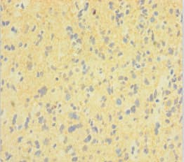 DNM1 / Dynamin Antibody (aa2-245)