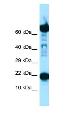 RPS11 / Ribosomal Protein 11 Antibody (C-Terminus)