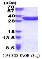 Human CCDC44 / TACO1 Protein (Recombinant His)