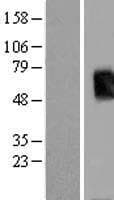 TBX19 / TPIT Protein (Over-Expression Lysate Myc-DDK (Flag))