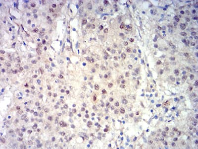 BCL11B Antibody (clone 1F8G8)