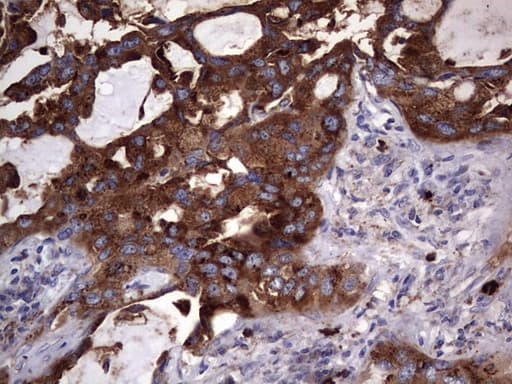 Monoclonal Mouse anti-Human CD63 Antibody (clone OTI5E5, IHC, WB)