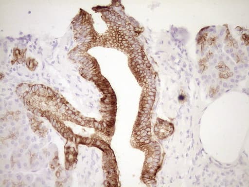 Monoclonal Mouse anti-Human KRT19 / CK19 / Cytokeratin 19 Antibody (clone OTI6A8, aa240-390, IHC, WB)