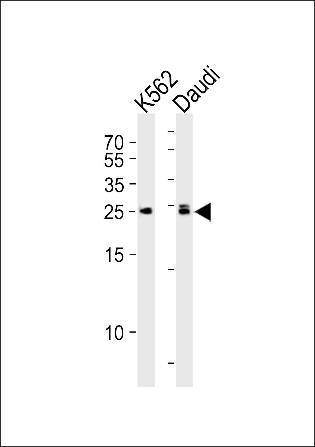 MOB1B / MOBKL1A Antibody (aa177-206)