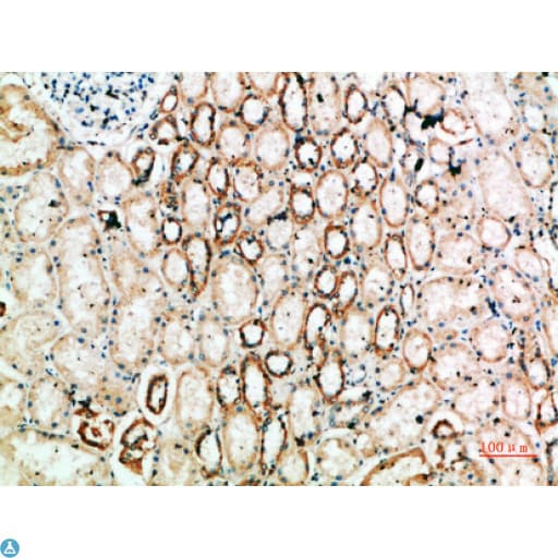 Polyclonal Rabbit anti-Human YARS / Tyrosyl-tRNA Synthetase Antibody (WB)