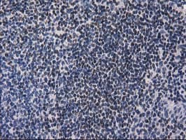 Monoclonal Mouse anti-Human ANKRD53 Antibody (clone OTI1E1, IHC, IF, WB)