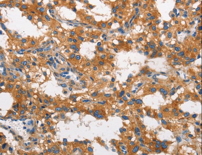 IHC-plus™ Polyclonal Rabbit anti-Human CLTC / Clathrin Heavy Chain Antibody (IHC, WB)