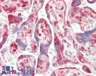 CRIP1 Antibody (N-Terminus)
