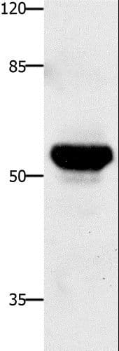 TNFRSF21 / DR6 Antibody