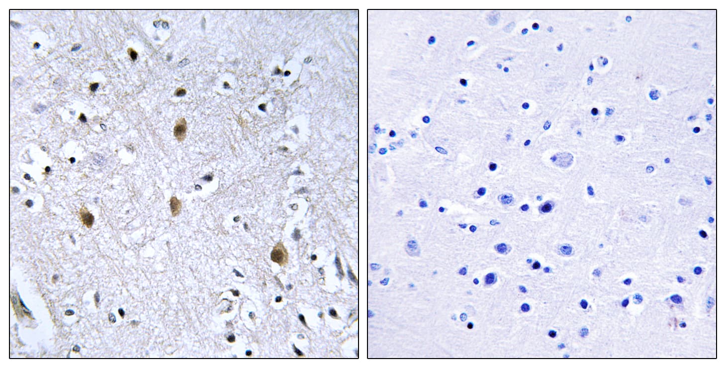 IRS1 Antibody (aa605-654)