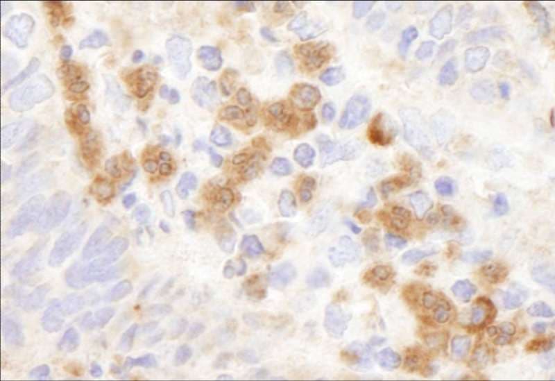 Polyclonal Rabbit anti-Human G6PD Antibody (aa50-100, IHC)