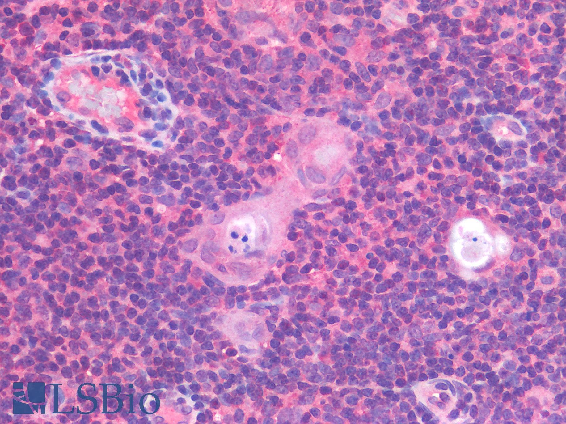 IHC-plus™ TNF Alpha Antibody