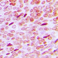 AR / Androgen Receptor Antibody (phospho-Ser213)
