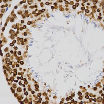 Polyclonal Rabbit anti-Human Histone H4 Antibody (Tri-Methyl-Lys20, IHC, IF, WB)
