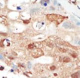 PIK3R2 / p85 Beta Antibody (aa268-298)