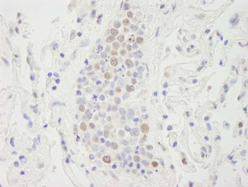 SUPT6H / SPT6 Antibody (aa425-475)