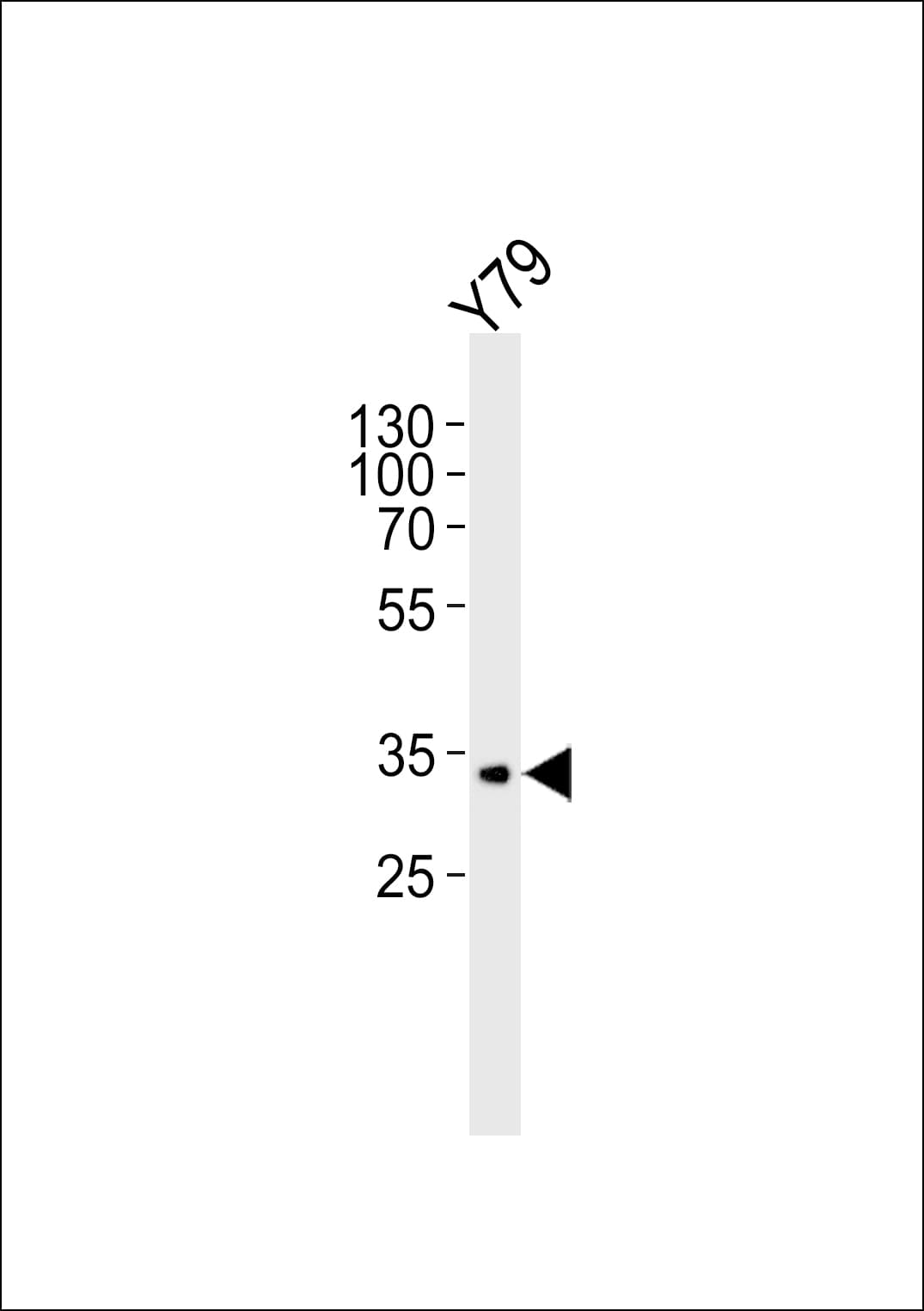 CRD / CRX Antibody (aa294-297)
