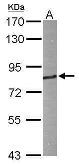 Polyclonal Rabbit anti-Human HHIP / HIP Antibody (aa263-554, IHC, WB)
