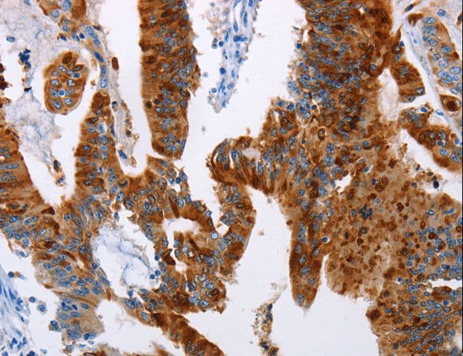 TFF3 / Trefoil Factor 3 Antibody