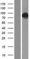 DCLRE1C / Artemis Protein (Over-Expression Lysate Myc-DDK (Flag))