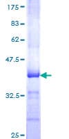 Human GNAL Protein (Recombinant GST, N-terminus)