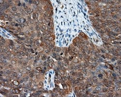 Monoclonal Mouse anti-Human NME4 Antibody (clone OTI1C11, IHC, IF, WB)