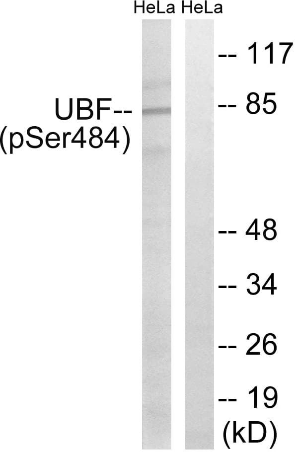 UBTF / UBF Antibody (phospho-Ser484)