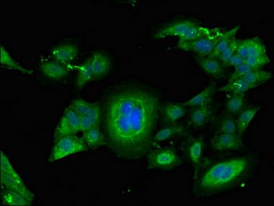 Polyclonal Rabbit anti-Human FGG / Fibrinogen Gamma Antibody (IHC, IF, WB)