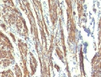 CALD1 / Caldesmon Antibody (clone CDSM-3)