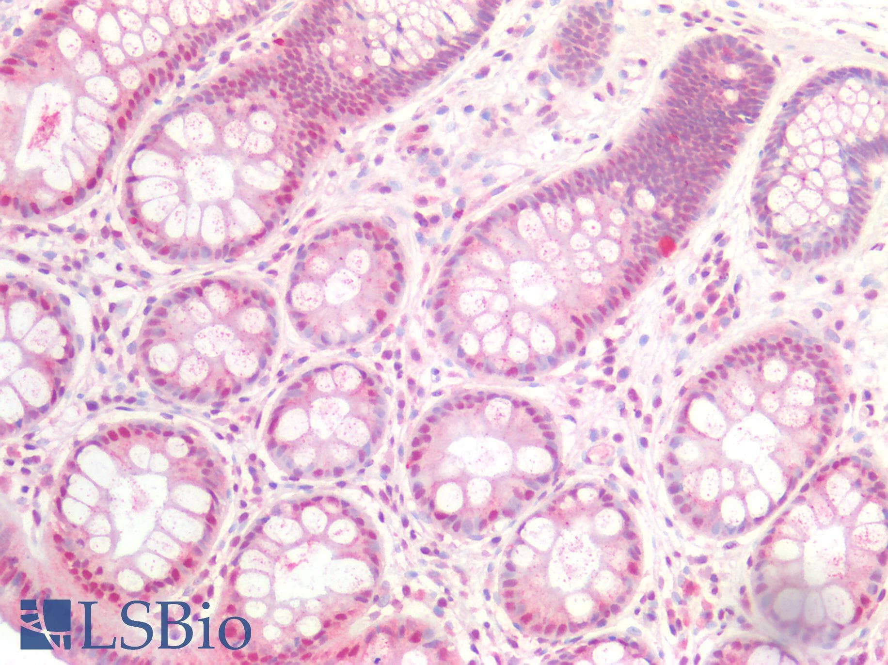 PathPlus™ SMAD3 Antibody