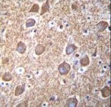 Polyclonal Rabbit anti-Human RASGRP2 Antibody (aa7-34, IHC, IF, WB)