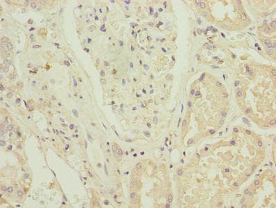 Polyclonal Rabbit anti-Human ZNF596 Antibody (IHC)