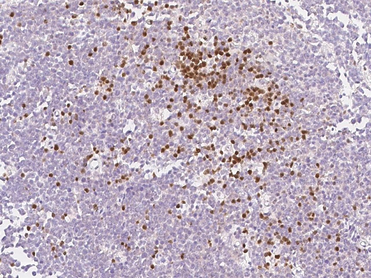 ZBP1 Antibody